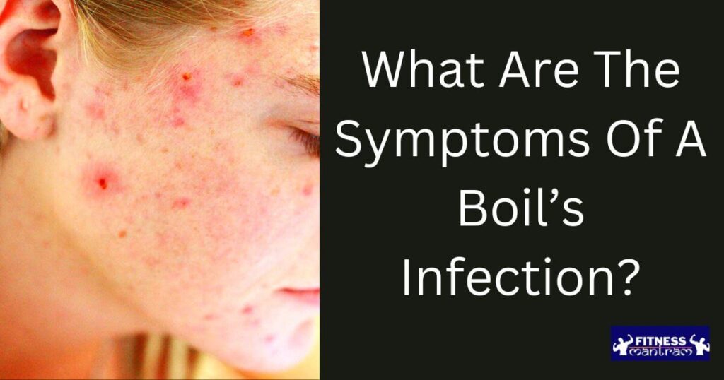 What are the symptoms of a boil’s infection?