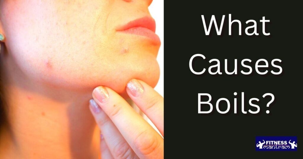  What Causes Boils